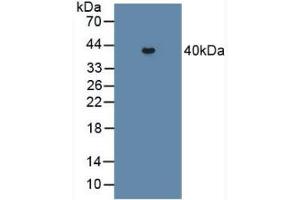 Figure. (PCOLCE2 Antikörper  (AA 297-415))