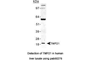 Image no. 2 for anti-Transmembrane Emp24-Like Trafficking Protein 10 (TMED10) (AA 100-200) antibody (ABIN363588) (TMED10 Antikörper  (AA 100-200))