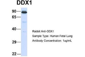 Host:  Rabbit  Target Name:  DDX1  Sample Type:  Human Fetal Lung  Antibody Dilution:  1. (DDX1 Antikörper  (Middle Region))