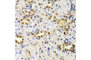 Immunohistochemistry of paraffin-embedded rat kidney using DNMT3A antibody at dilution of 1:200 (400x lens). (DNMT3A Antikörper)