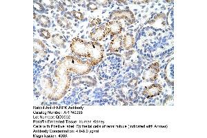 Rabbit Anti-HNRPK Antibody  Paraffin Embedded Tissue: Human Kidney Cellular Data: Epithelial cells of renal tubule Antibody Concentration: 4. (HNRNPK Antikörper  (N-Term))
