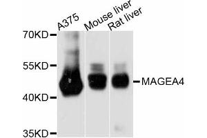 Western blot analysis of extracts of various cell lines, using MAGEA4 antibody. (MAGEA4 Antikörper)