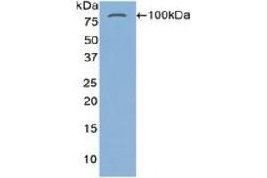 Western Blotting (WB) image for Transglutaminase 2 (C Polypeptide, Protein-Glutamine-gamma-Glutamyltransferase) (TGM2) ELISA Kit (ABIN6574289)