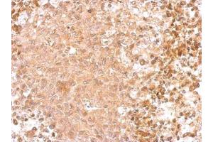 IHC-P Image GAD65 antibody [C2C3], C-term detects GAD2 protein at cytosol on RT2 xenograft by immunohistochemical analysis. (GAD65 Antikörper  (C-Term))