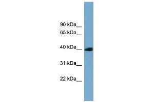 CXORF9 antibody used at 1 ug/ml to detect target protein. (SASH3 Antikörper  (N-Term))
