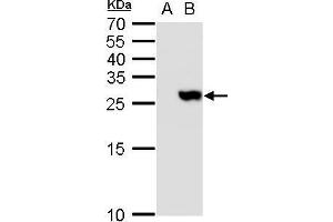 WB Image TMS1 antibody detects TMS1 protein by western blot analysis.