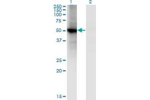 Western Blot analysis of RORB expression in transfected 293T cell line by RORB monoclonal antibody (M01), clone 4B4. (RORB Antikörper  (AA 136-224))