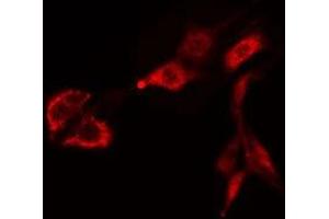 ABIN6275468 staining Hela cells by IF/ICC. (RAB38 Antikörper  (Internal Region))
