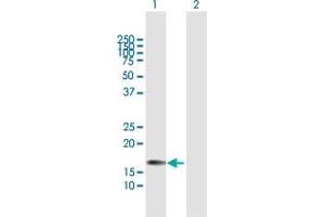 Western Blot analysis of CSF3 expression in transfected 293T cell line by CSF3 MaxPab polyclonal antibody.