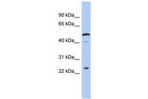 Image no. 1 for anti-Chromosome 1 Open Reading Frame 190 (C1orf190) (AA 143-192) antibody (ABIN6744005) (Chromosome 1 Open Reading Frame 190 (C1orf190) (AA 143-192) Antikörper)