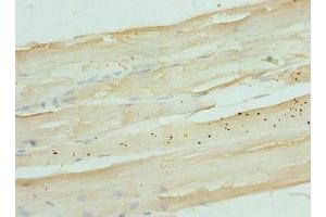 Immunohistochemistry of paraffin-embedded human skeletal muscle tissue using ABIN7165854 at dilution of 1:100 (NDRG2 Antikörper  (AA 152-371))