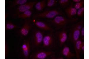 Immunofluorescence staining of methanol-fixed Hela cells using Myc(Phospho-Thr358) Antibody. (c-MYC Antikörper  (pThr358))