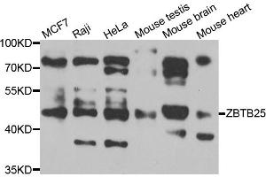 Western blot analysis of extracts of various cell lines, using ZBTB25 antibody (ABIN5975302) at 1/1000 dilution. (ZBTB25 Antikörper)