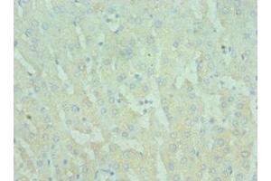 Immunohistochemistry of paraffin-embedded human liver tissue using ABIN7172290 at dilution of 1:100 (TIRAP Antikörper  (AA 1-221))