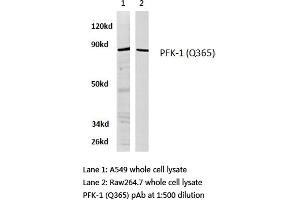 Western blot (WB) analysis of PFK-1 antibody in extracts from A549 and raw264. (PFKL Antikörper)