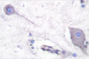 Image no. 2 for anti-Signal-Regulatory Protein alpha (SIRPA) antibody (ABIN271815) (SIRPA Antikörper)