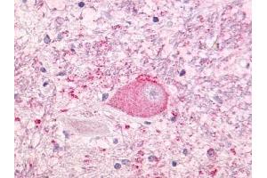 Immunohistochemical staining of Brain (Neurons and glia) using anti- NTSR1 antibody ABIN122341 (NTSR1 Antikörper)