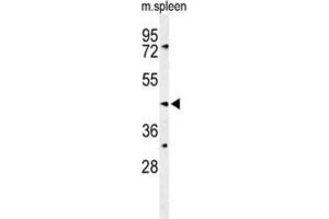 Western Blotting (WB) image for anti-Sphingomyelin Synthase 2 (SGMS2) antibody (ABIN3004297) (Sphingomyelin Synthase 2 Antikörper)