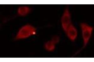 ABIN6278554 staining 293 cells by IF/ICC.