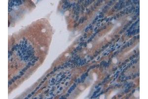 Used in DAB staining on fromalin fixed paraffin- embedded liver tissue (CXCL7 Antikörper  (AA 46-107))