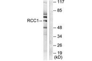 Western blot analysis of extracts from LOVO cells, using RCBTB1 Antibody. (RCBTB1 Antikörper  (AA 251-300))