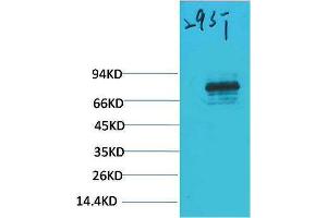 Western Blotting (WB) image for anti-Signal Transducer and Activator of Transcription 3 (Acute-Phase Response Factor) (STAT3) antibody (ABIN3188049) (STAT3 Antikörper)