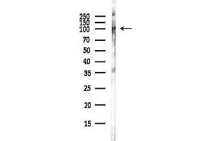 Western blot analysis of lysates from COLO205 cells(heat-shock,45 min treatment), using Phospho-EP (Tyr660/Tyr418) Antibody at 1/1000 dilution.