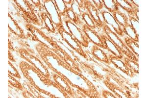 Formalin-fixed, paraffin-embedded human Renal Cell Carcinoma stained with Calnexin Mouse Monoclonal Antibody (CANX/1541). (Calnexin Antikörper  (N-Term))
