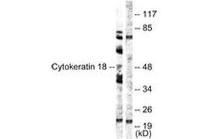 Western Blotting (WB) image for anti-Keratin 18 (KRT18) (AA 21-70) antibody (ABIN2888816) (Cytokeratin 18 Antikörper  (AA 21-70))