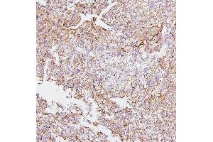 IHC analysis of CYP2E1 using anti-CYP2E1 antibody (ABIN7601446).