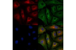 ABIN6260643 and ABIN6278194 staining  cells by IF/ICC.