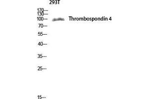 Western Blot (WB) analysis of 293T lysis using Thrombospondin 4 antibody.