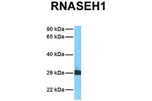 Host:  Rabbit  Target Name:  RNASEH1  Sample Tissue:  Human Jurkat  Antibody Dilution:  1. (Ribonuclease H1 Antikörper  (Middle Region))