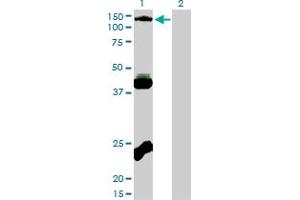 Western Blot analysis of EPHB3 expression in transfected 293T cell line by EPHB3 monoclonal antibody (M01), clone 1B3. (EPH Receptor B3 Antikörper  (AA 899-997))