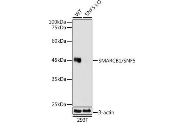 SMARCB1 anticorps
