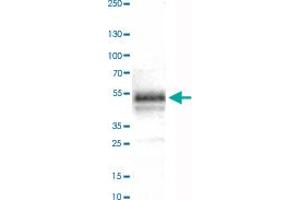 Western Blot analysis of human tonsil tissue lysate with CA12 monoclonal antibody, clone CL0278 . (CA12 Antikörper)