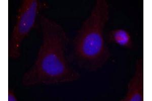 Immunofluorescence staining of methanol-fixed Hela cells using Pyk2(Phospho-Tyr402) Antibody.