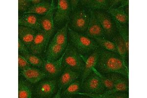 IF analysis of hnRNP E2/PCBP2 using anti-hnRNP E2/PCBP2 antibody (ABIN7599983) and anti-Tubulin Alpha antibody (ABIN7600339). (PCBP2 Antikörper  (AA 136-276))