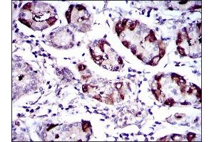 Immunohistochemical analysis of paraffin-embedded stomach tissues using SLC27A5 mouse mAb with DAB staining.
