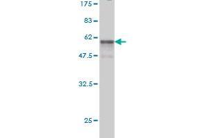 Western Blot detection against Immunogen (53. (SSR1 Antikörper  (AA 33-286))