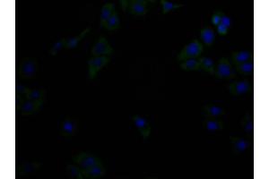 Immunofluorescence staining of Hela cells with(ABIN7176749)at 1:90, counter-stained with DAPI. (Histone 3 Antikörper  (AA 21-228))
