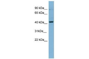 PRKCB1 antibody used at 1 ug/ml to detect target protein. (Pkc beta 1 Antikörper  (N-Term))
