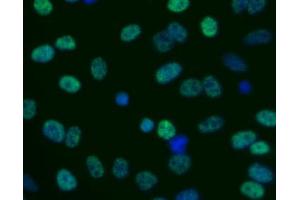 Immunofluorescent staining of human cell line (H2AFX Antikörper  (pSer139))