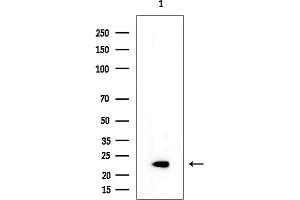 Western blot analysis of lysates from Mouse testis, using CRYGS Mouse Monoclonal Antibody at 1/1000 dilution.