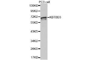 Western blot analysis of extracts of PC-3 cells, using KBTBD3 antibody. (KBTBD3 Antikörper  (AA 410-607))