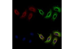 ABIN7094749 and ABIN7098800 staining Hela cells by IF/ICC. (BASP1 Antikörper  (N-Term))