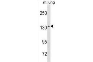 Western Blotting (WB) image for anti-SEC31 Homolog A (SEC31A) antibody (ABIN3001341) (SEC31A Antikörper)