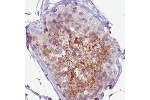 Immunohistochemical staining (Formalin-fixed paraffin-embedded sections) of human testis with PCM1 monoclonal antibody, clone CL0206  shows moderate immunoreactivity in seminiferous tubules. (PCM1 Antikörper)