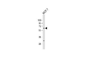Anti-ZN Antibody (N-term) at 1:500 dilution + MCF-7 whole cell lysate Lysates/proteins at 20 μg per lane. (ZNF835 Antikörper  (N-Term))