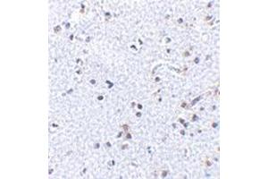 Immunohistochemistry of TSLP in human brain tissue with this product at 2. (Thymic Stromal Lymphopoietin Antikörper  (C-Term))